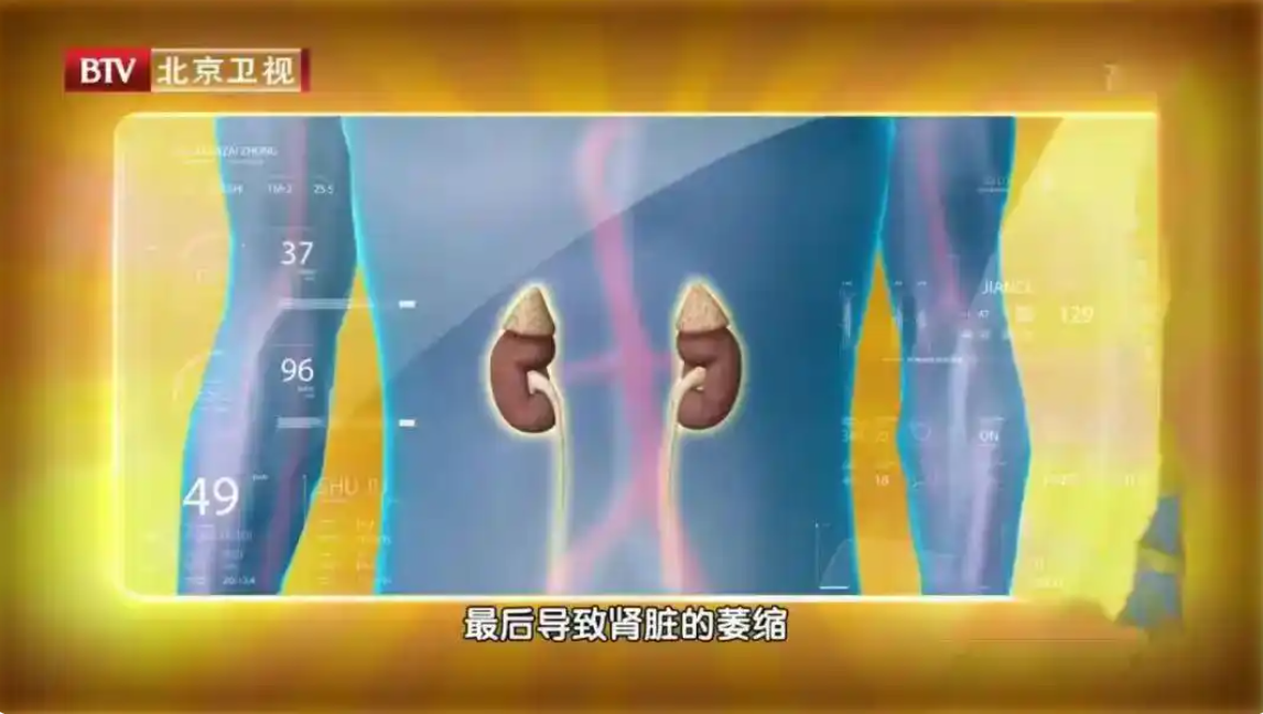 12.png