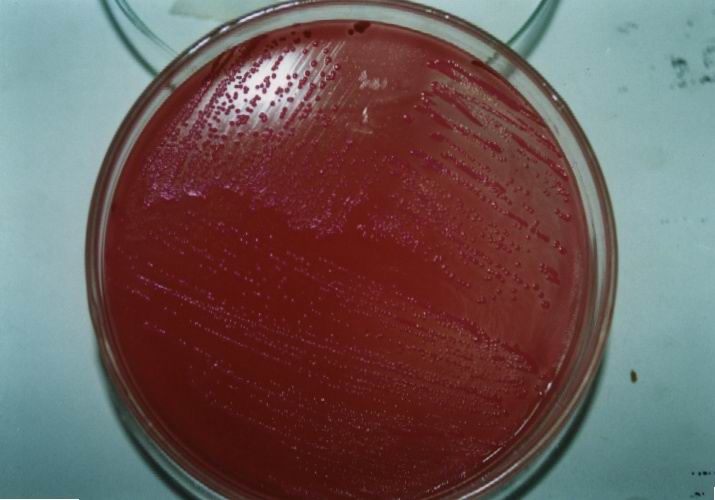 大肠杆菌在麦康凯培养基上长成红色菌落