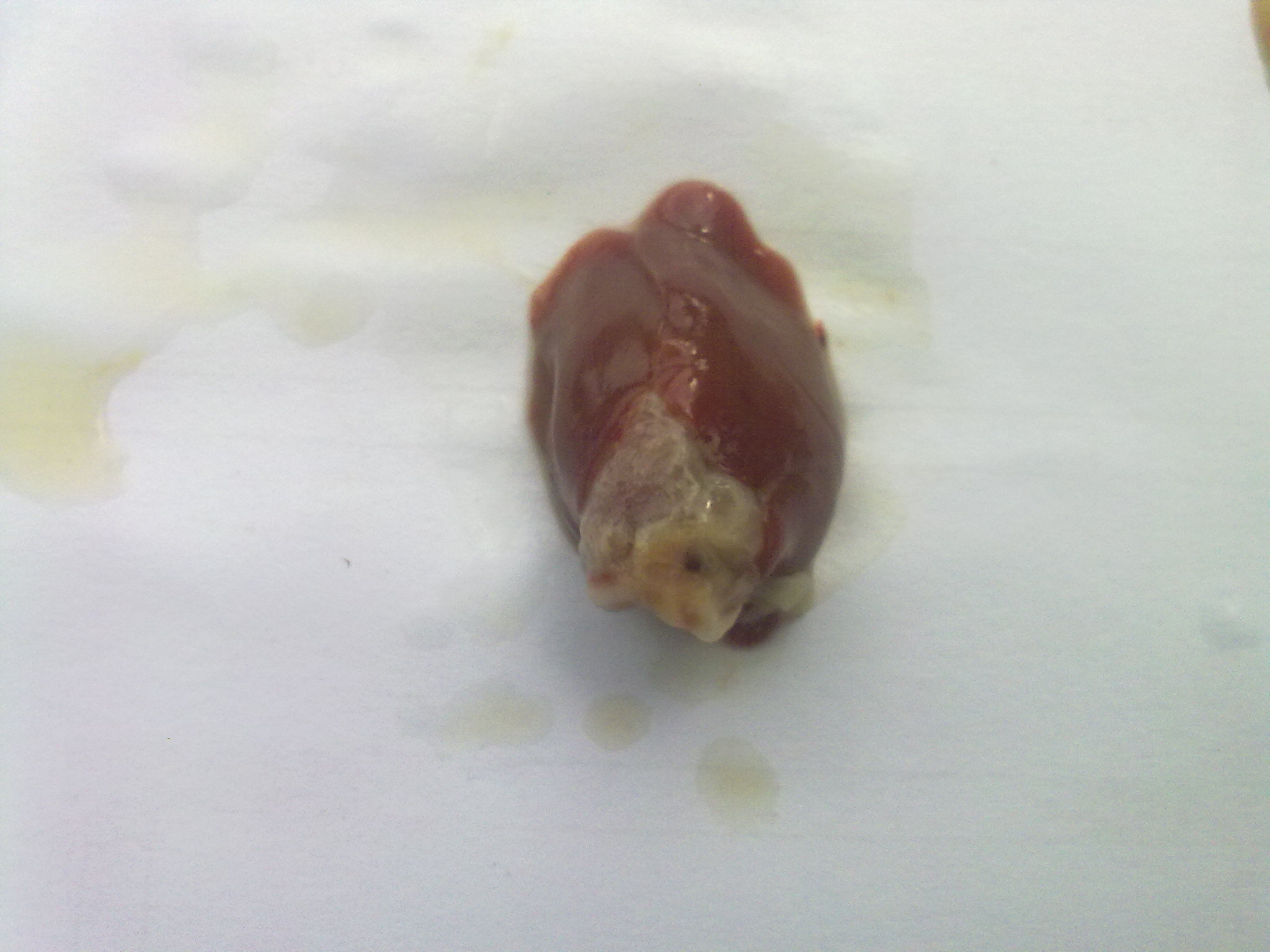 20120101665.jpg