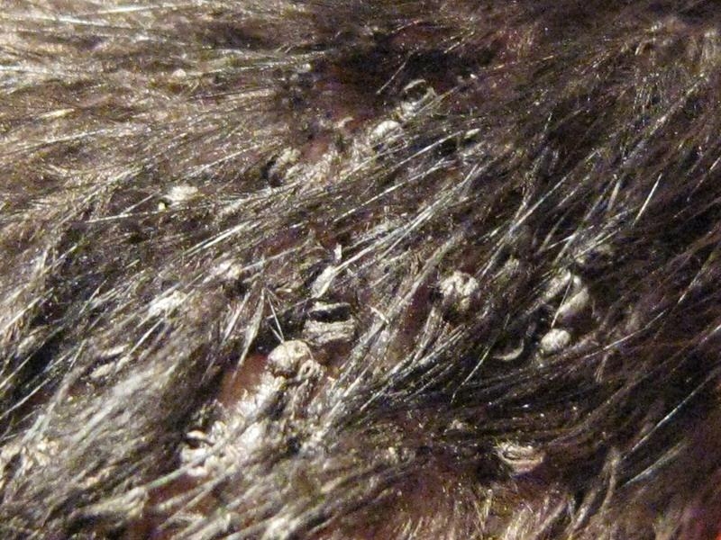 虱子虱子长在头发上的图片身上长虱子
