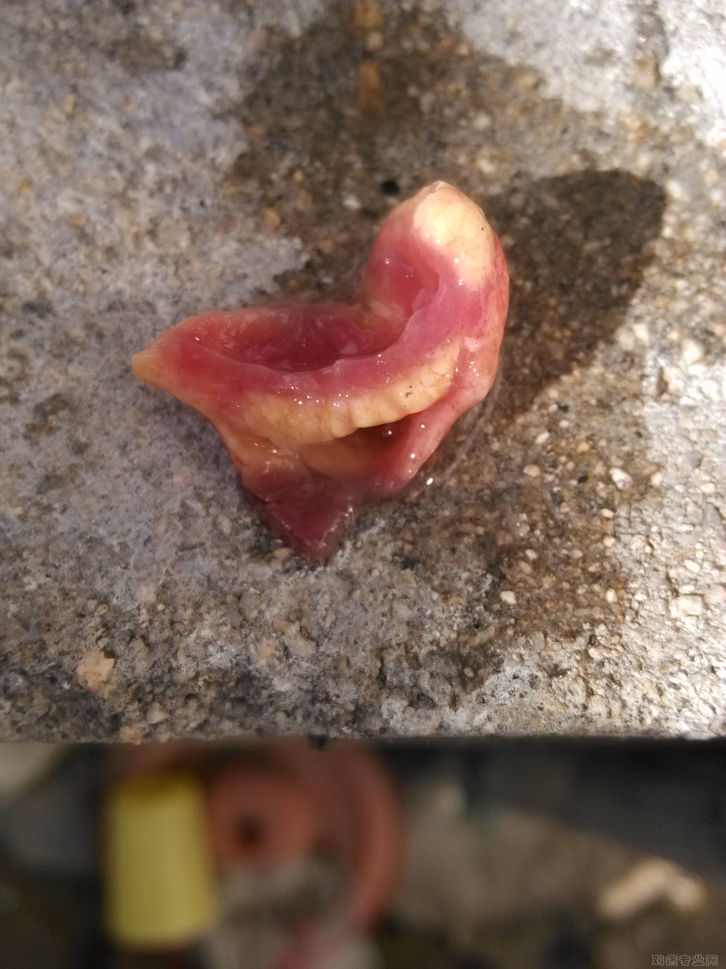 1（4）心脏抛开
