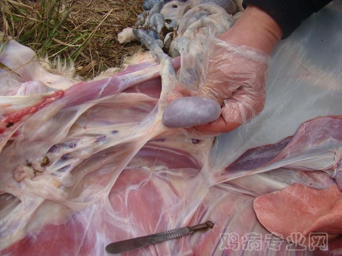 肾结核.JPG