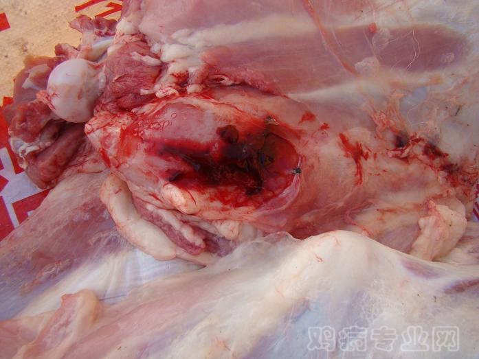 脊椎断裂.JPG