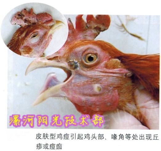 皮肤型鸡痘7.jpg