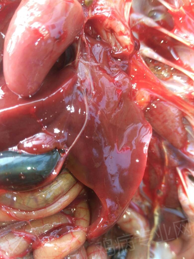 肝脏有圆型坏死灶